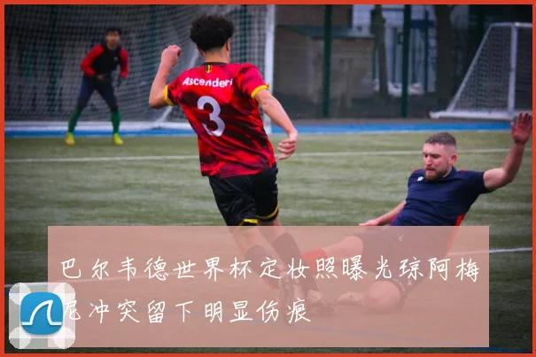 巴尔韦德世界杯定妆照曝光琼阿梅尼冲突留下明显伤痕